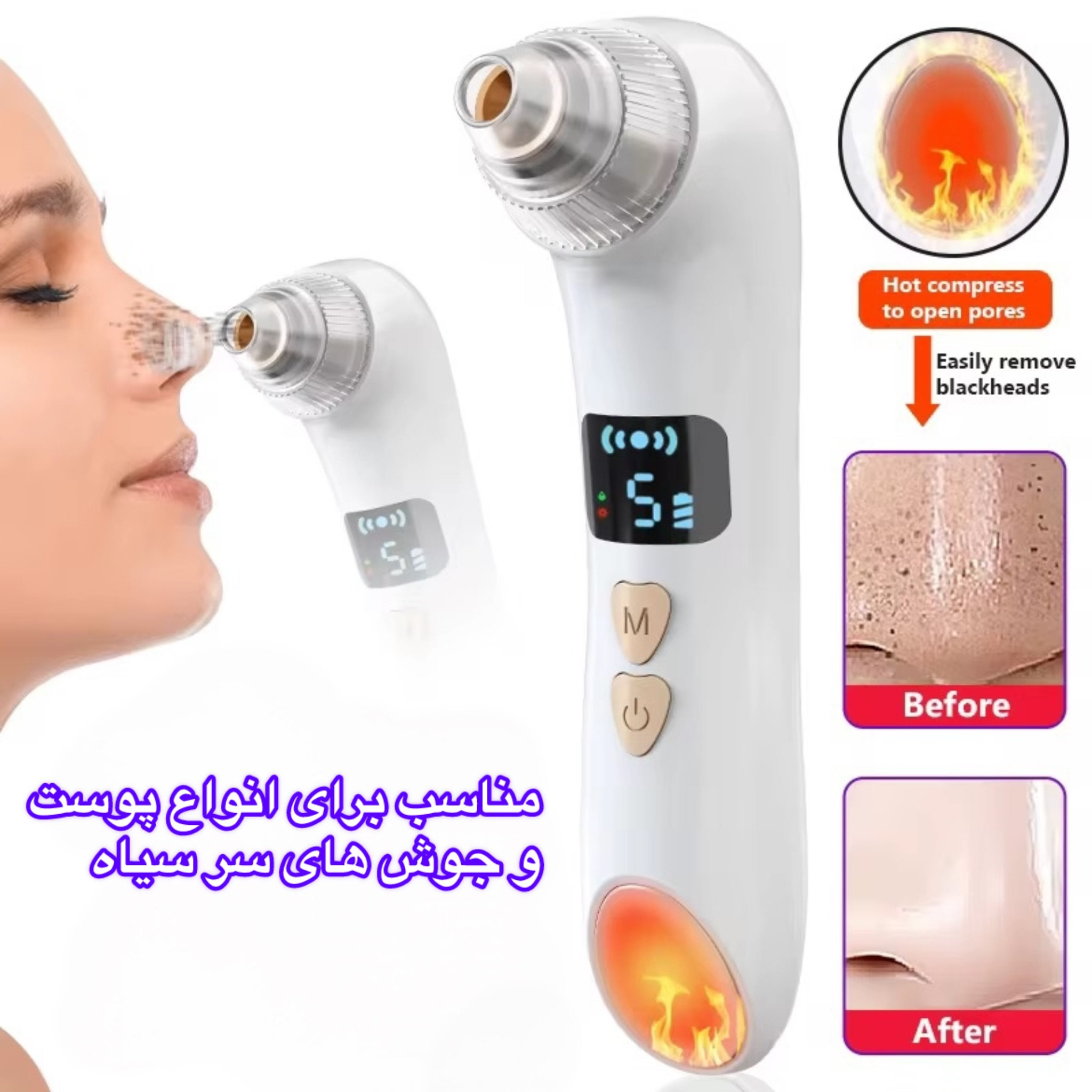 میکرودرم مدل 2IN1 Heater
