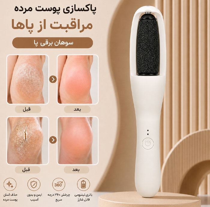سنگ پا برقی با موبر نانو کریستالی مدل S10