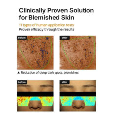 کرم ضد لک صورت سلیمکس مدل Pore Dark Spot وزن 35 گرم