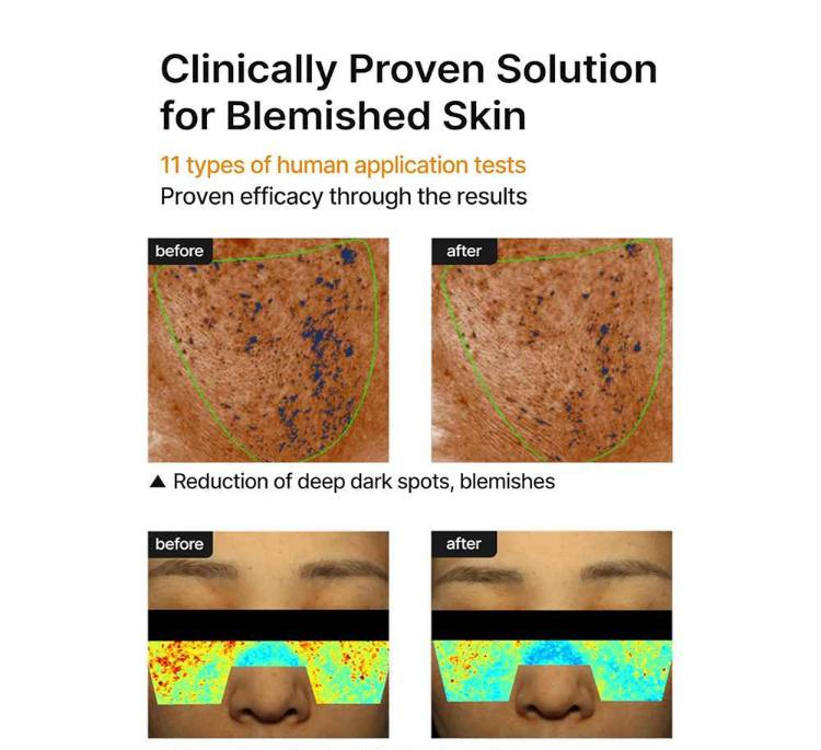کرم ضد لک صورت سلیمکس مدل Pore Dark Spot وزن 35 گرم
