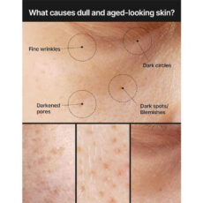 کرم ضد لک صورت سلیمکس مدل Pore Dark Spot وزن 35 گرم
