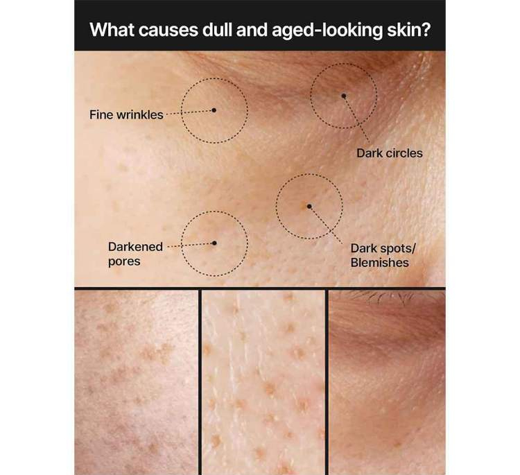 کرم ضد لک صورت سلیمکس مدل Pore Dark Spot وزن 35 گرم